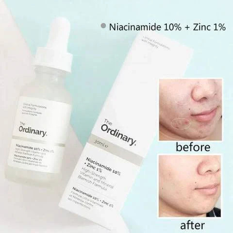 The Ordinary Niacinamide 10% +Zinc 1% 30ml