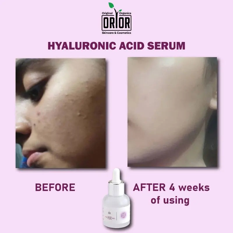 Hydrating Hyaluronic Acid + B5 serum